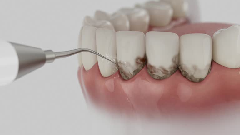Reliable Dental Implants contractor in Show Low, AZ by Smile Center Dentistry